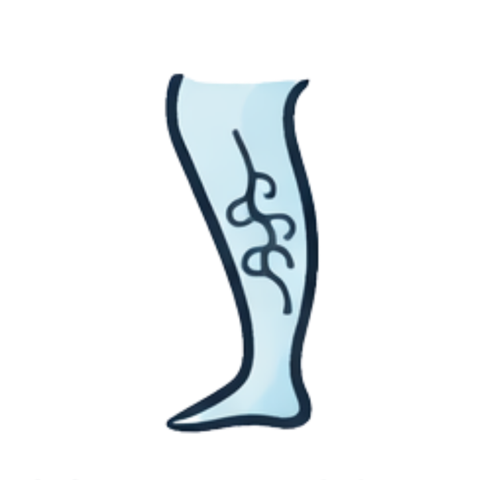 Varicose Veins
